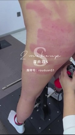 预览图11