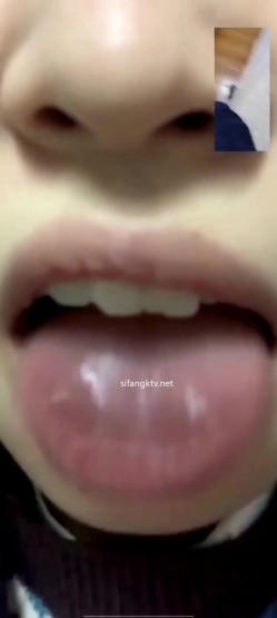 预览图11