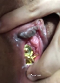 预览图14